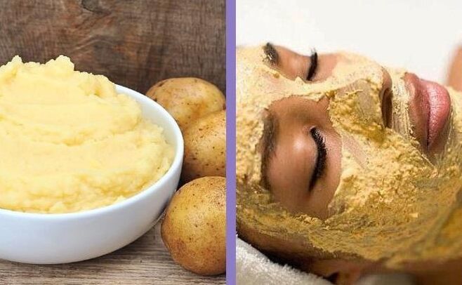 Kartoshka niqobi